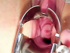 Faye Gyno Exam With Pussy Gaping